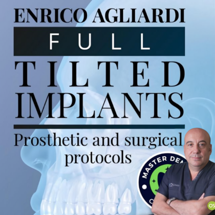 Full tilted implants: Prosthetic and Surgical protocols​