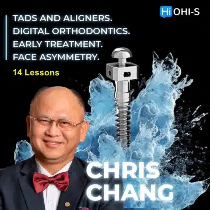 TADs and aligners, Digital orthodontics, Early treatment, Face asymmetry