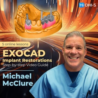 EXOCAD Implant Restorations – Step-by-step Video Guide