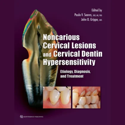 Noncarious Cervical Lesions and Cervical Dentin Hypersensitivity