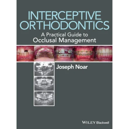 Interceptive Orthodontics: A Practical Guide to Occlusal Management
