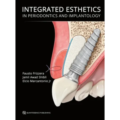 Integrated Esthetics in Periodontics and Implantology