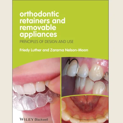 Orthodontic Retainers and Removable Appliances