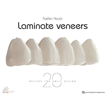 Laminate Veneers: 20 Recipes for Smile Design
