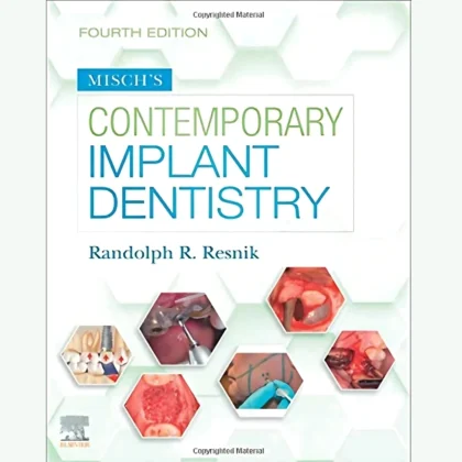 Misch's Contemporary Implant Dentistry