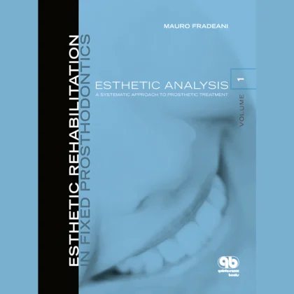Esthetic Rehabilitation in Fixed Prosthodontics: Prosthetic Treatment, a Systematic Approach to Esthetic, Biologic, and Functional Integration