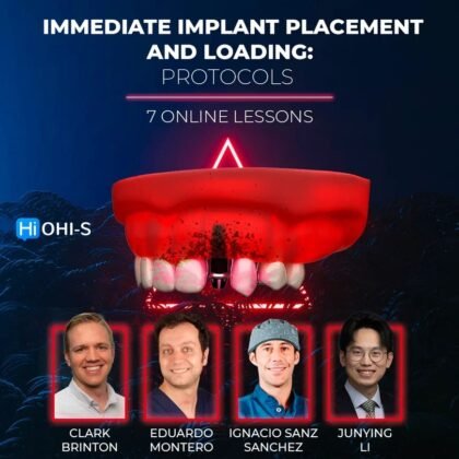 Immediate Implant Placement and Loading Surgical Protocols