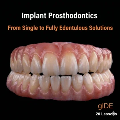 Implant Prosthodontics – From Single to Fully Edentulous Solutions