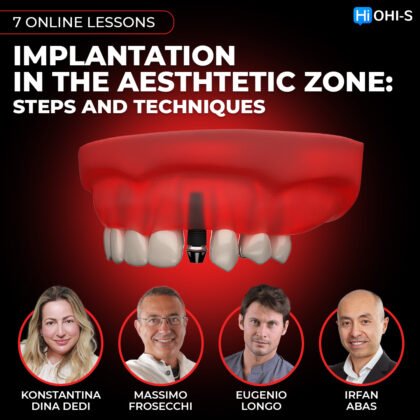 Implant placement in the aesthetic zone: steps and techniques
