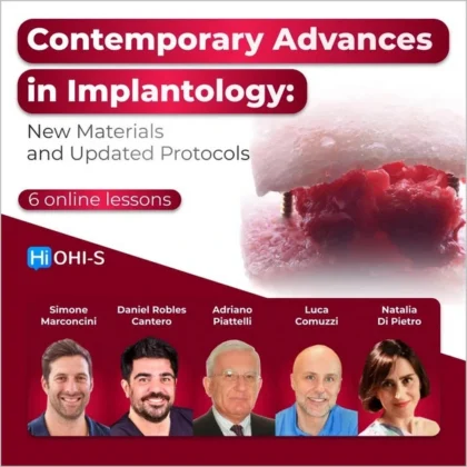 Contemporary Advances in Implantology: New Materials and Updated Protocols