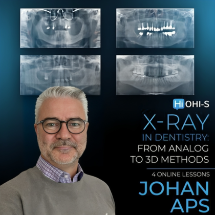 X-ray in Dentistry: From Analog to 3D Methods