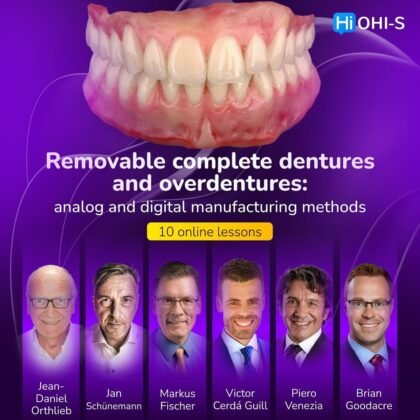 Removable complete dentures and overdentures