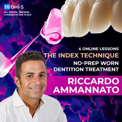 The Index Technique. No-prep worn dentition treatment