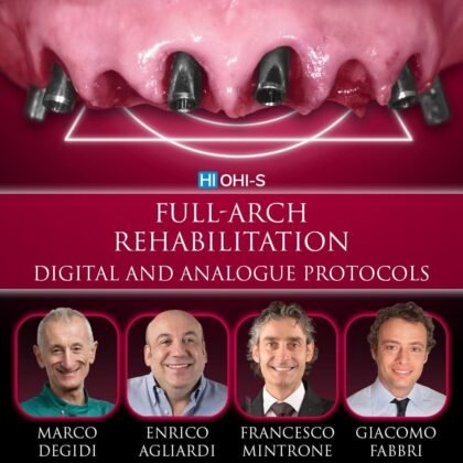 Full-arch rehabilitation: digital and  analogue Protocols