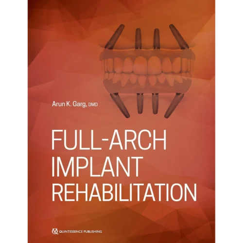 Full-Arch Implant Rehabilitation Full-Arch Implant Rehabilitation