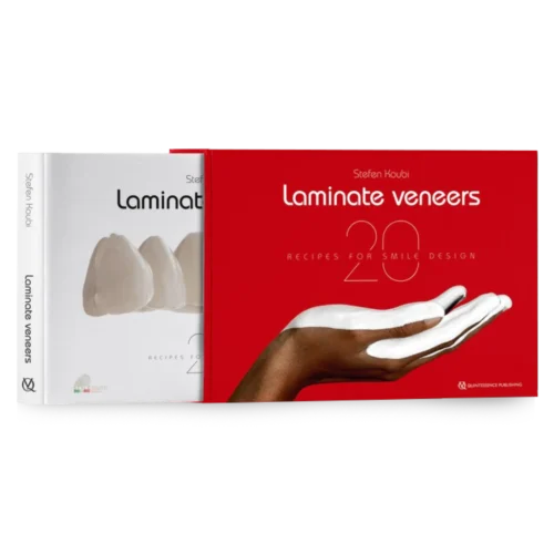 Laminate Veneers 20 Recipes for Smile Design Laminate Veneers: 20 Recipes for Smile Design