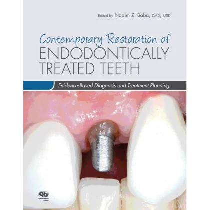 Contemporary Restoration of Endodontically Treated Teeth: Evidence-Based Diagnosis and Treatment Planning