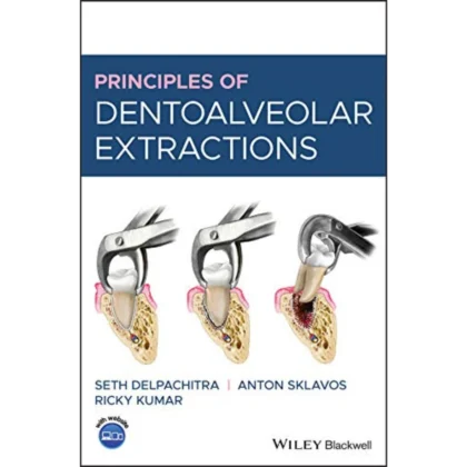 Principles of Dentoalveolar Extractions