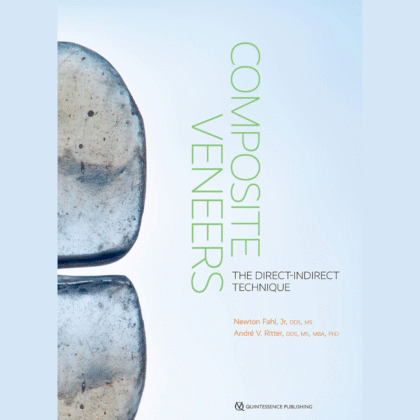 Composite Veneers: The Direct-Indirect Technique