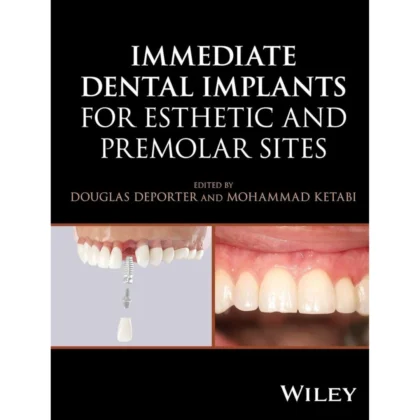 Immediate Dental Implants for Esthetic and Premolar Sites