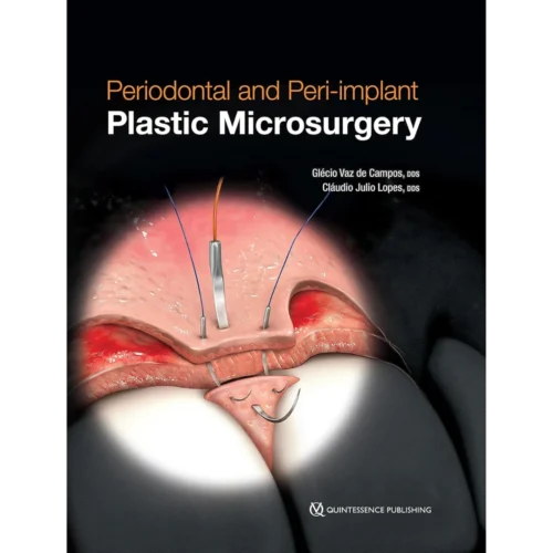 Periodontal and Peri-implant Plastic Microsurgery Periodontal and Peri-implant Plastic Microsurgery: Minimally Invasive Techniques with Maximum Precision