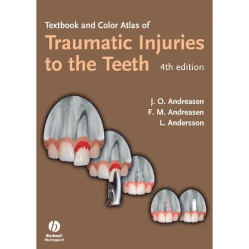 Textbook And Color Atlas Of Traumatic Injuries To The Teeth