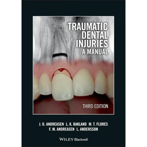 Traumatic Dental Injuries