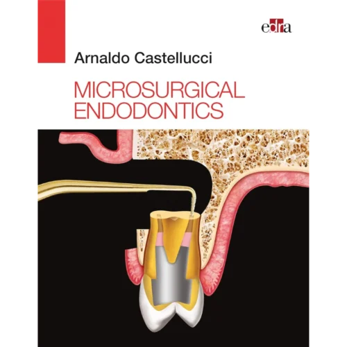 Microsurgical Endodontics