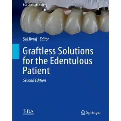 Graftless Solutions for the Edentulous Patient