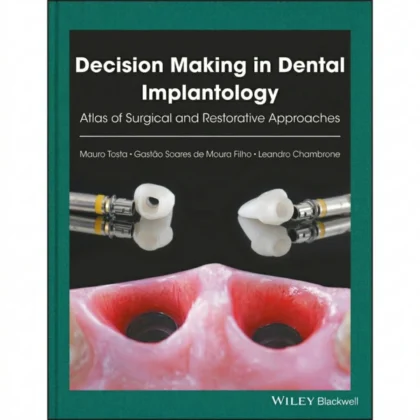 Decision Making in Dental Implantology: Atlas of Surgical and Restorative Approaches