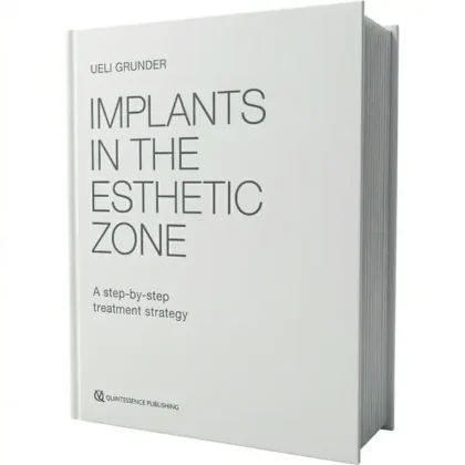 Implants in the Esthetic Zone: A Step-by-Step Treatment Strategy