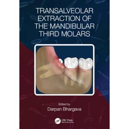 Transalveolar Extraction of the Mandibular Third Molars
