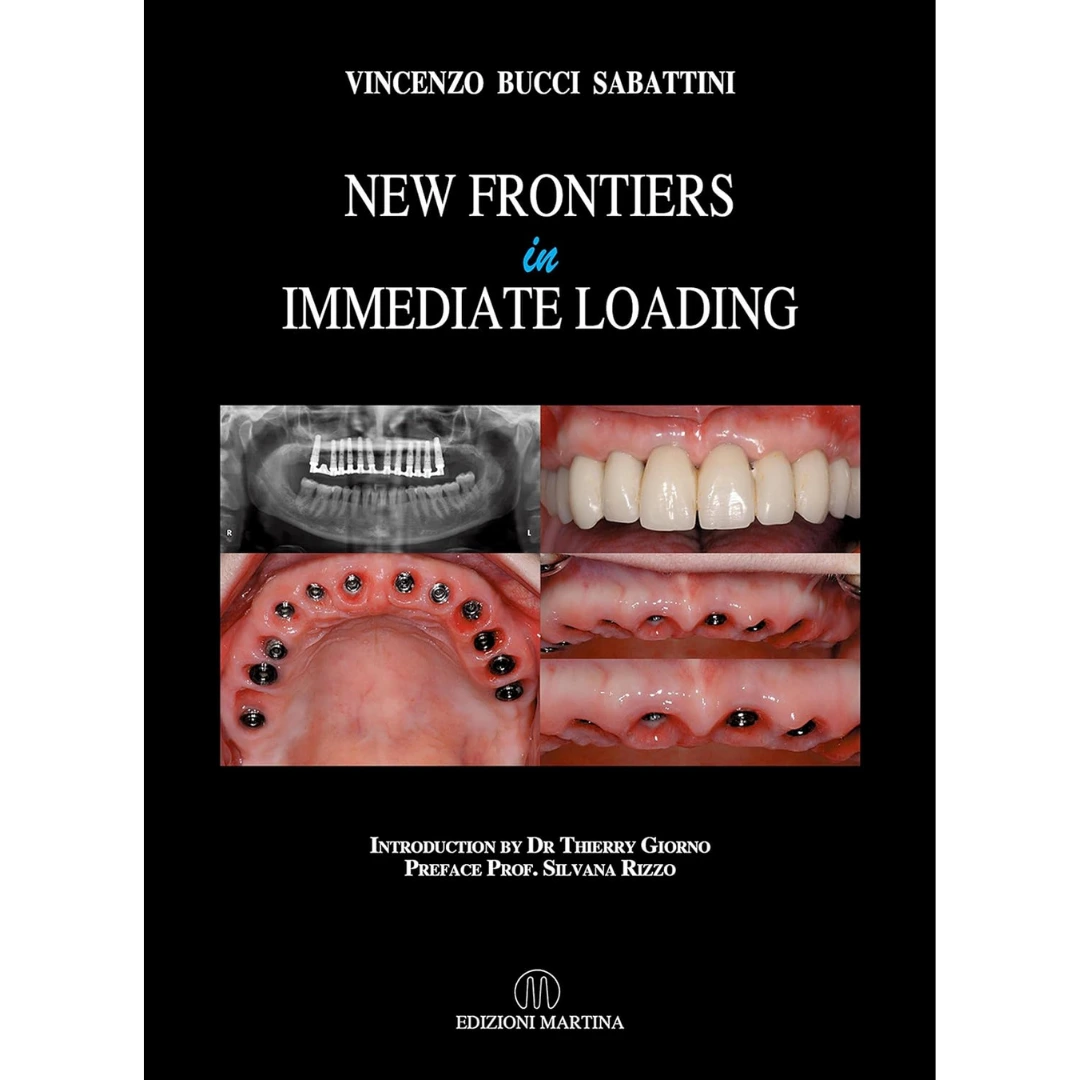 New Frontiers In Immediate Loading