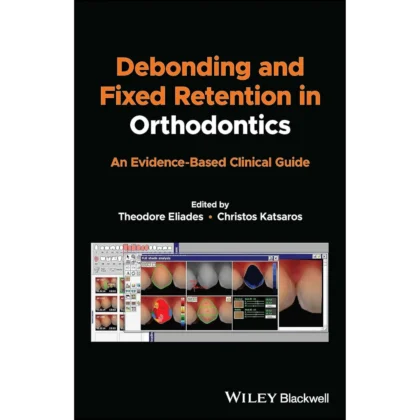Debonding and Fixed Retention in Orthodontics: An Evidence-Based Clinical Guide
